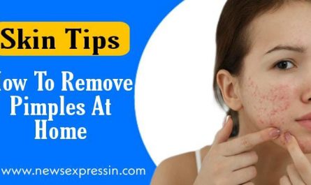 मुहासों और उनके दाग से छुटकारा पायें | How To Remove Pimple Marks On Face Naturally