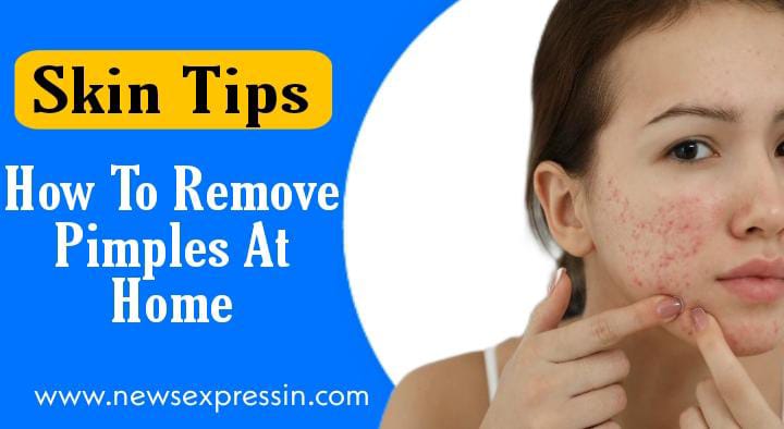 मुहासों और उनके दाग से छुटकारा पायें | How To Remove Pimple Marks On Face Naturally