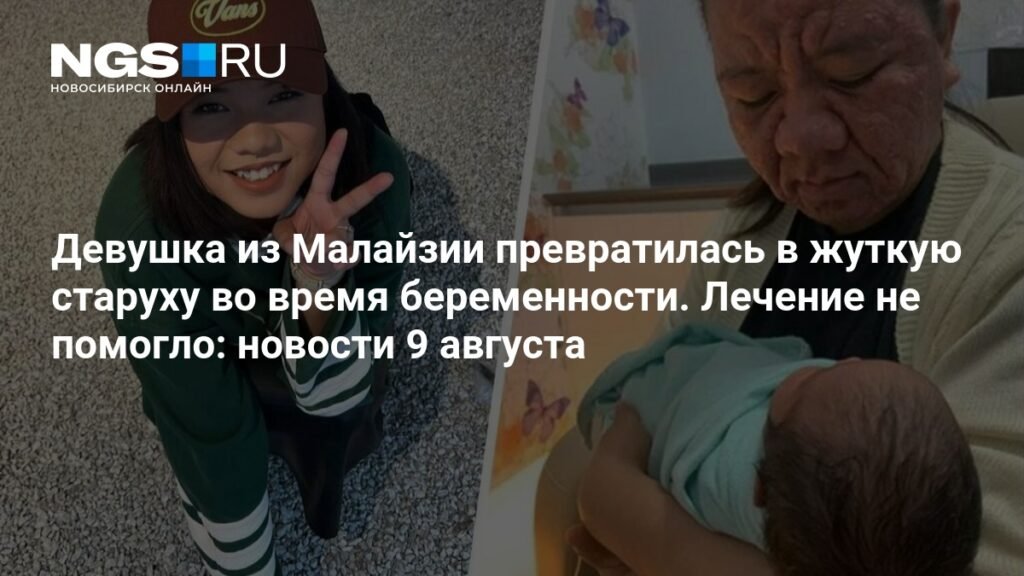 Девушка из Малайзии резко постарела во время беременности