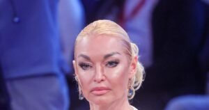 Волочкова столкнулась с проблемой выпадения волос: мнение эксперта