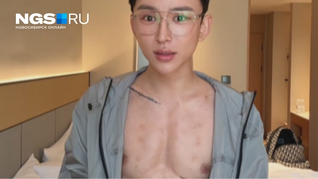 Китайский блогер 'накачал' пресс уколами гиалуронки за 45 млн рублей