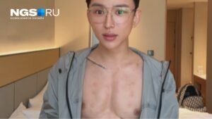 Китайский блогер 'накачал' пресс уколами гиалуронки за 45 млн рублей