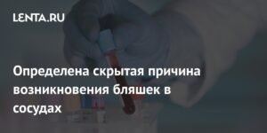 Скрытая причина атеросклероза: роль транспортера аминокислот