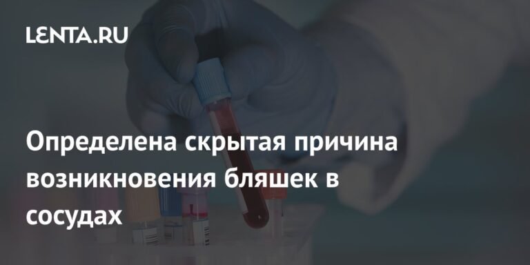 Скрытая причина атеросклероза: роль транспортера аминокислот