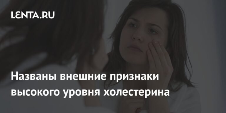 Внешние признаки высокого уровня холестерина: как заметить проблему
