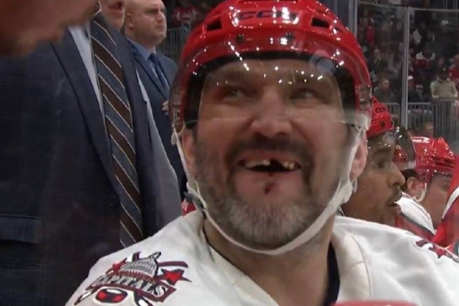 Овечкину разбили лицо и сломали зуб в матче НХЛ