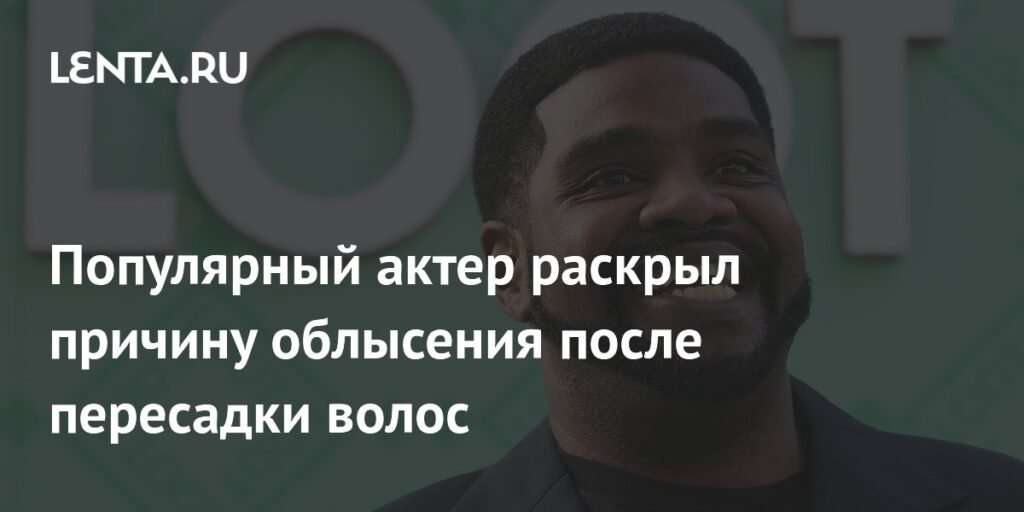 Рон Фанчес объяснил причину облысения после пересадки волос