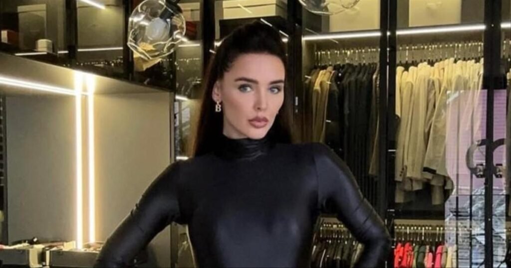 Светлана Сигал сделала новую пластику лица у другого хирурга