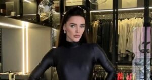 Светлана Сигал сделала новую пластику лица у другого хирурга