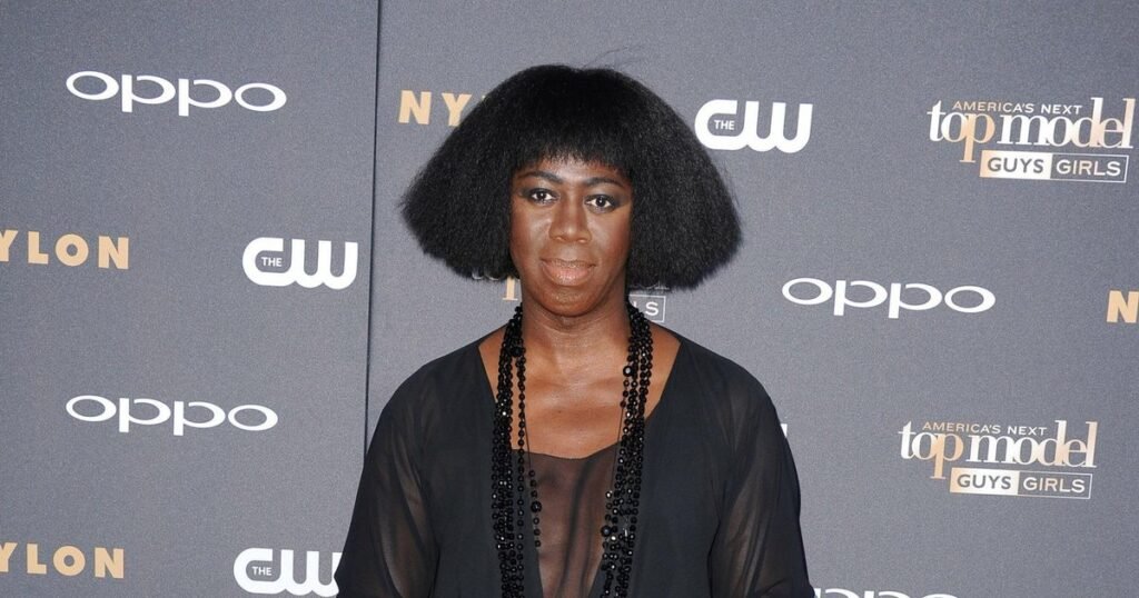 Джей Александр из «Топ-модели по-американски» - борьба с последствиями инсульта