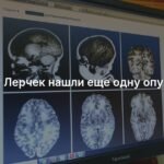У Лерчек обнаружена новая опухоль в мозге