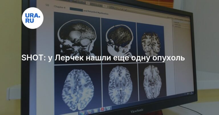 У Лерчек обнаружена новая опухоль в мозге